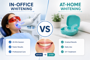 Difference Between In-Office and At-Home Teeth Whitening
