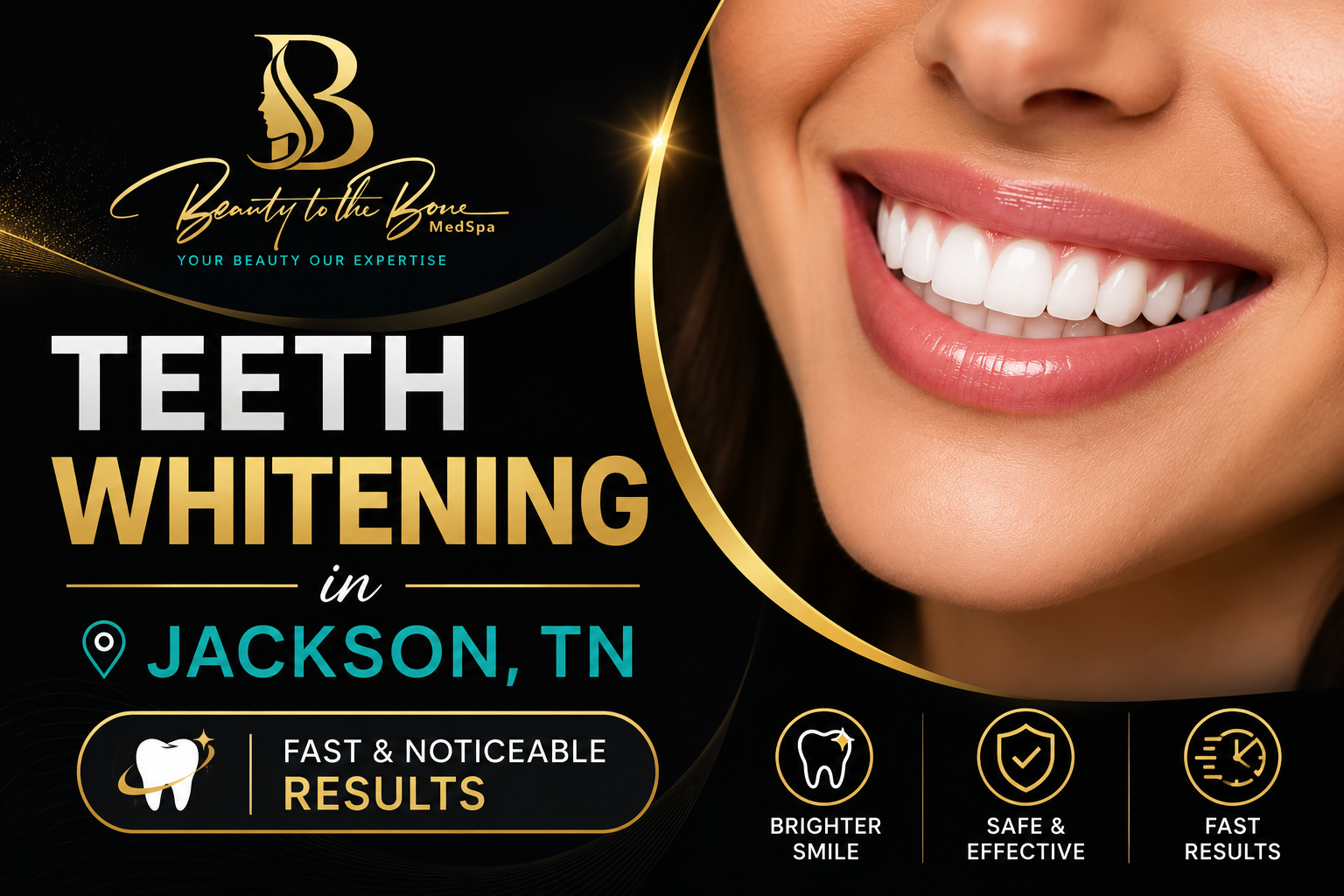 Teeth Whitening in Jackson